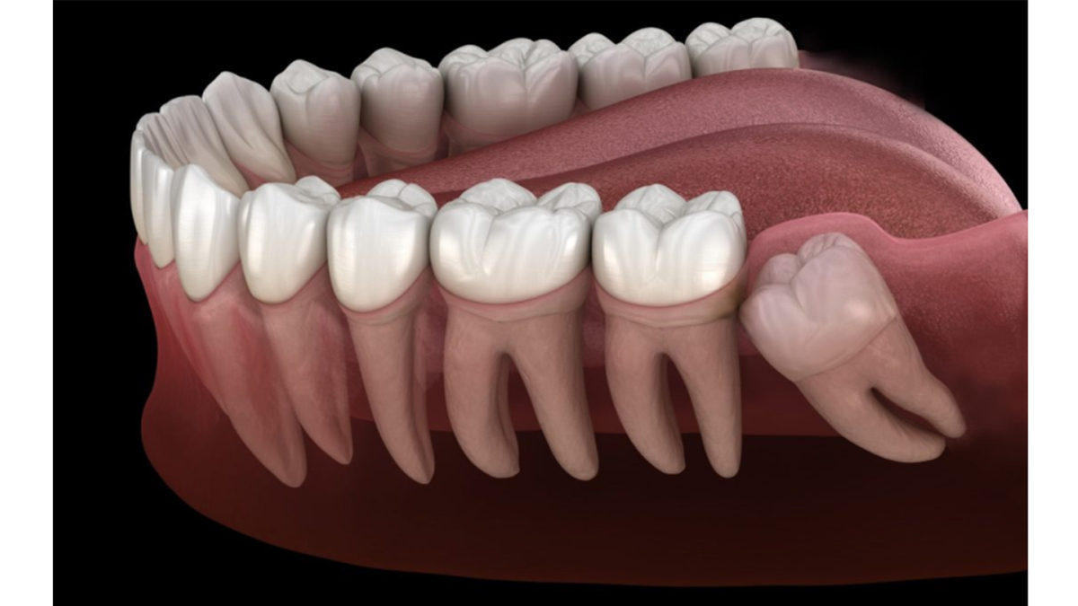 치아보험추천비교